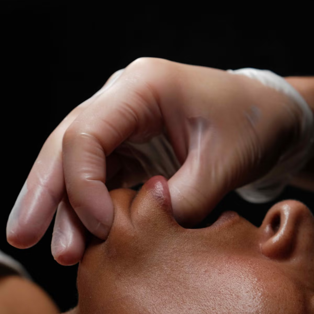 Face Therapy